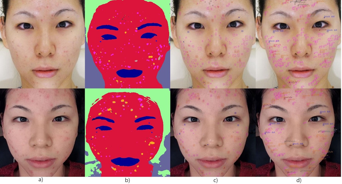 featured image - RethNet Model: Object-by-Object Learning for Detecting Facial Skin Problems
