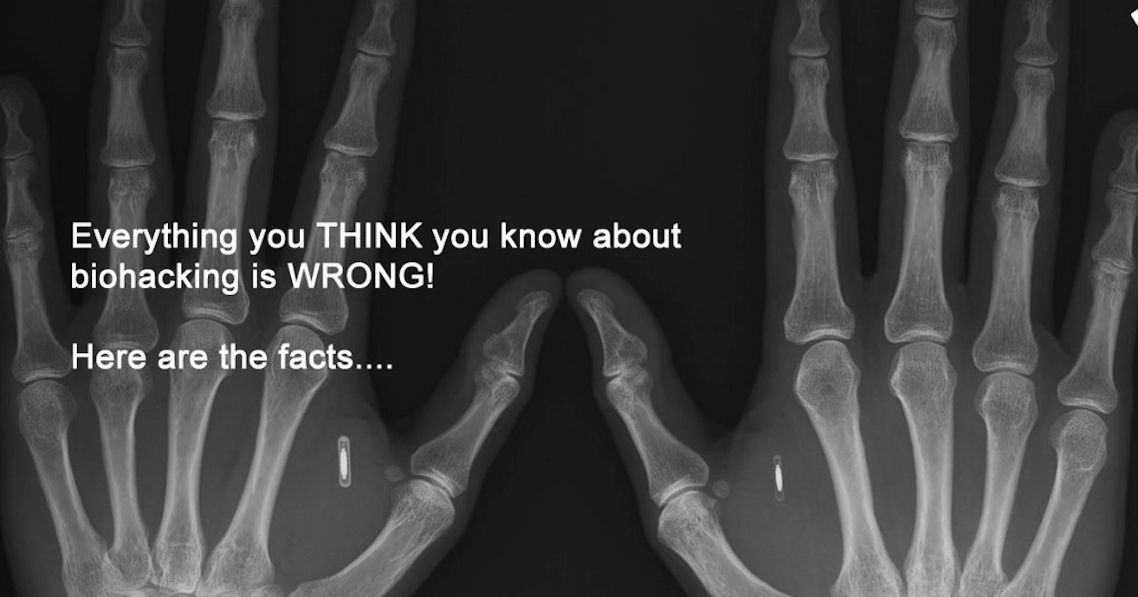 Everything you THINK you know about biohacking is WRONG. Here are the facts….