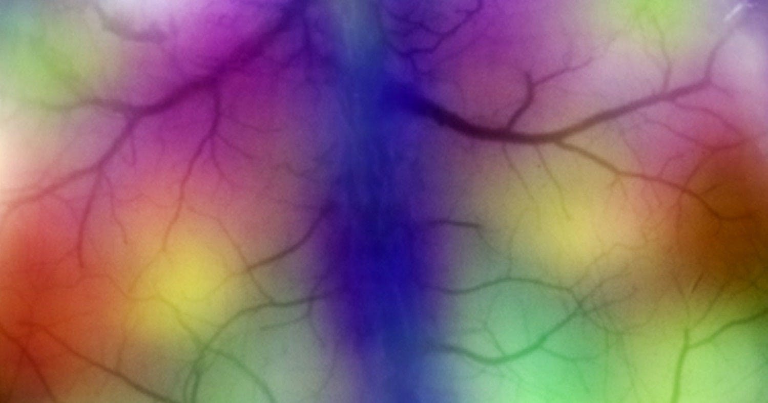 /music-as-precision-medicine-could-music-take-the-place-of-drugs-d6678631fd33 feature image