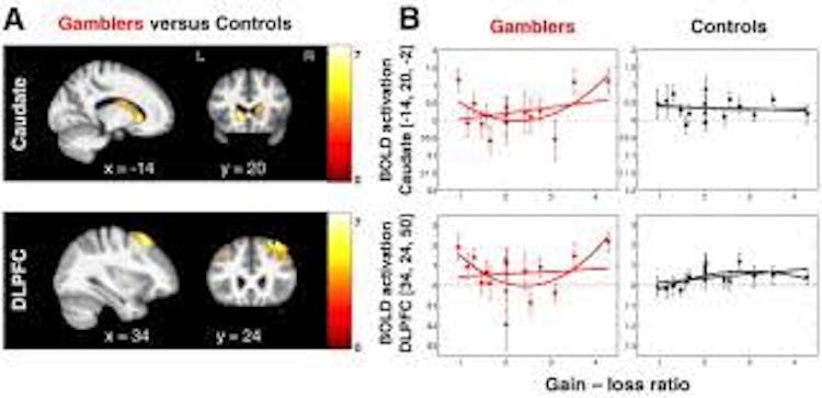 Gamblers vs Controls