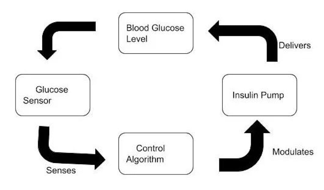 Figure 3: Artificial Pancreas