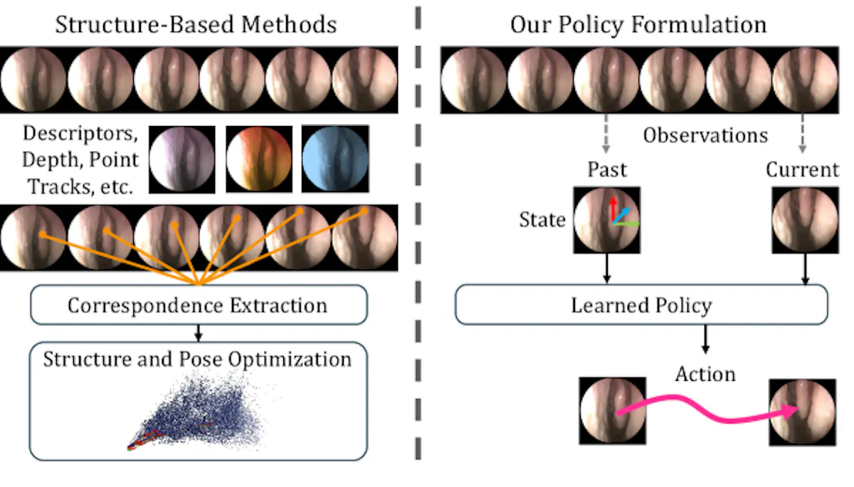 featured image - A New AI Approach to Surgical Navigation Skips Reconstruction