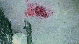 Article Thumbnail