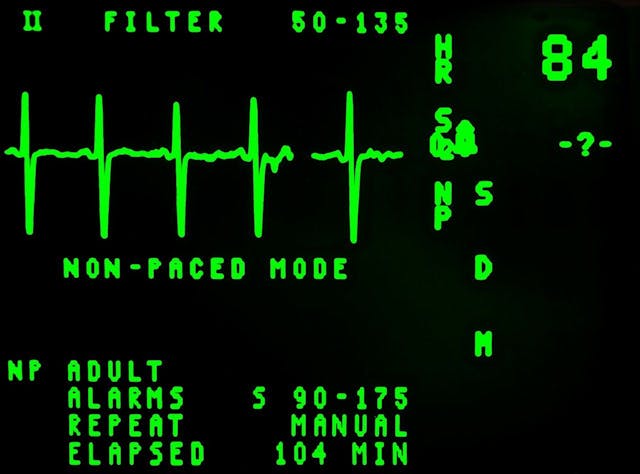 /iot-in-healthcare-benefits-and-examples-nq1b31dp feature image