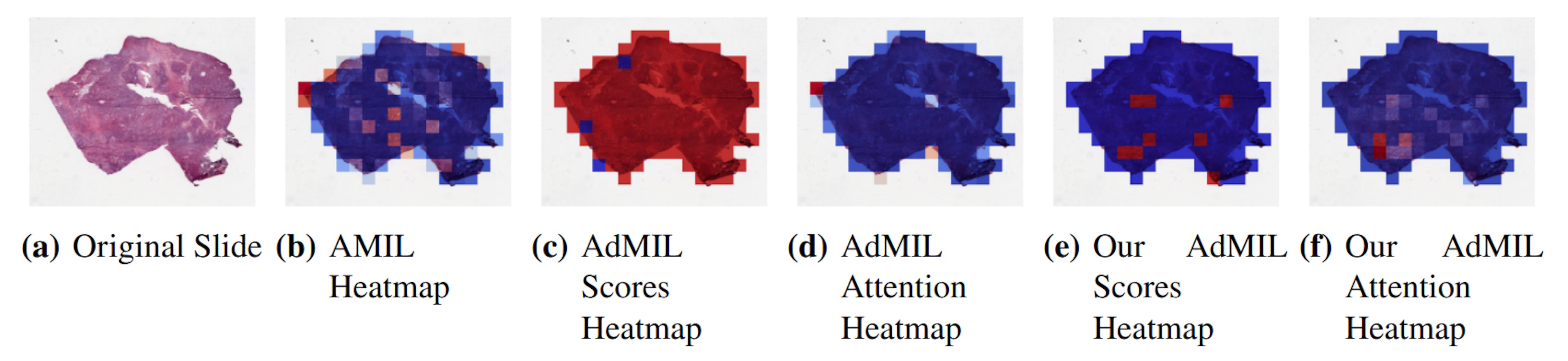 How AI Models Are Rethinking Tumor Detection at the Tissue Level