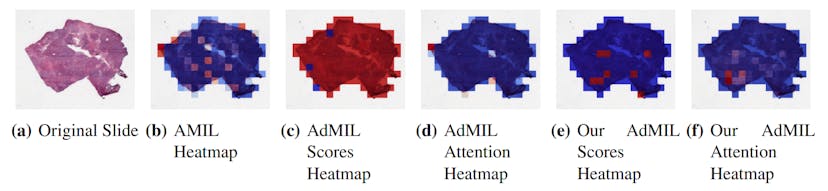 /how-ai-models-are-rethinking-tumor-detection-at-the-tissue-level feature image