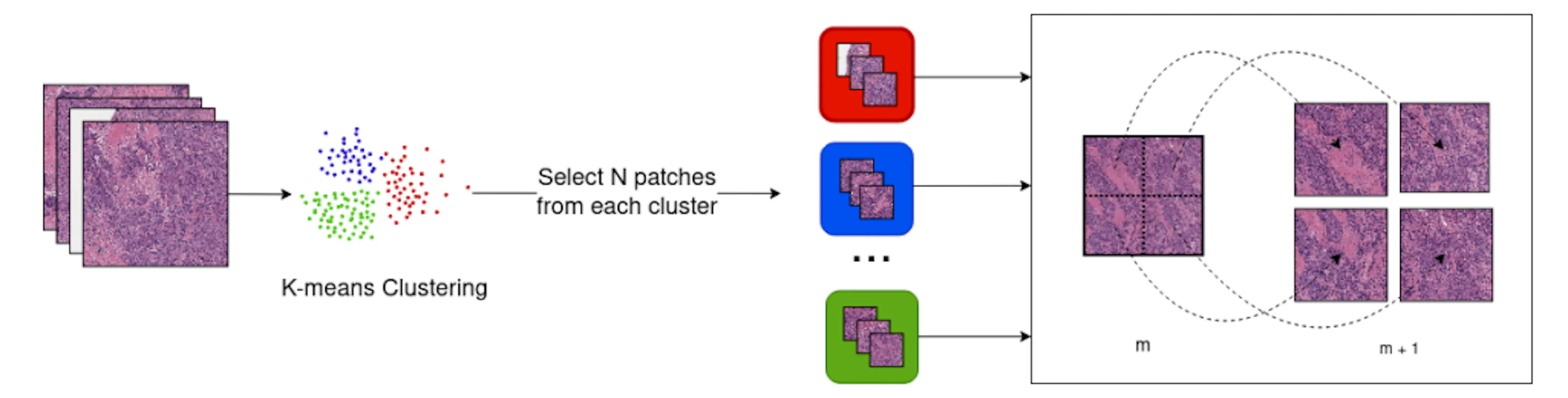 How We Trained AI Models to Detect Tumors and Gene Mutations