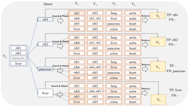 /how-ai-retrieves-anatomical-structures-using-vector-databases feature image