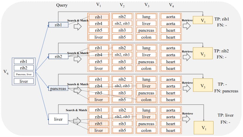 /how-ai-retrieves-anatomical-structures-using-vector-databases feature image