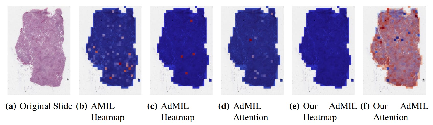 featured image - Why Detecting TP53 Mutations in Digital Slides Remains a Challenge