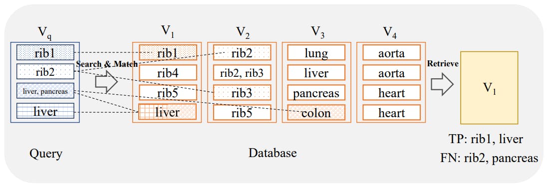 /building-a-cbir-benchmark-with-totalsegmentator-and-faiss feature image