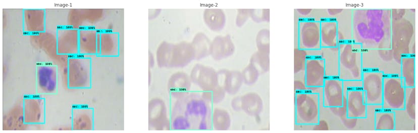 /learn-to-build-train-and-export-retinanet-resnet-50-on-a-custom-dataset feature image