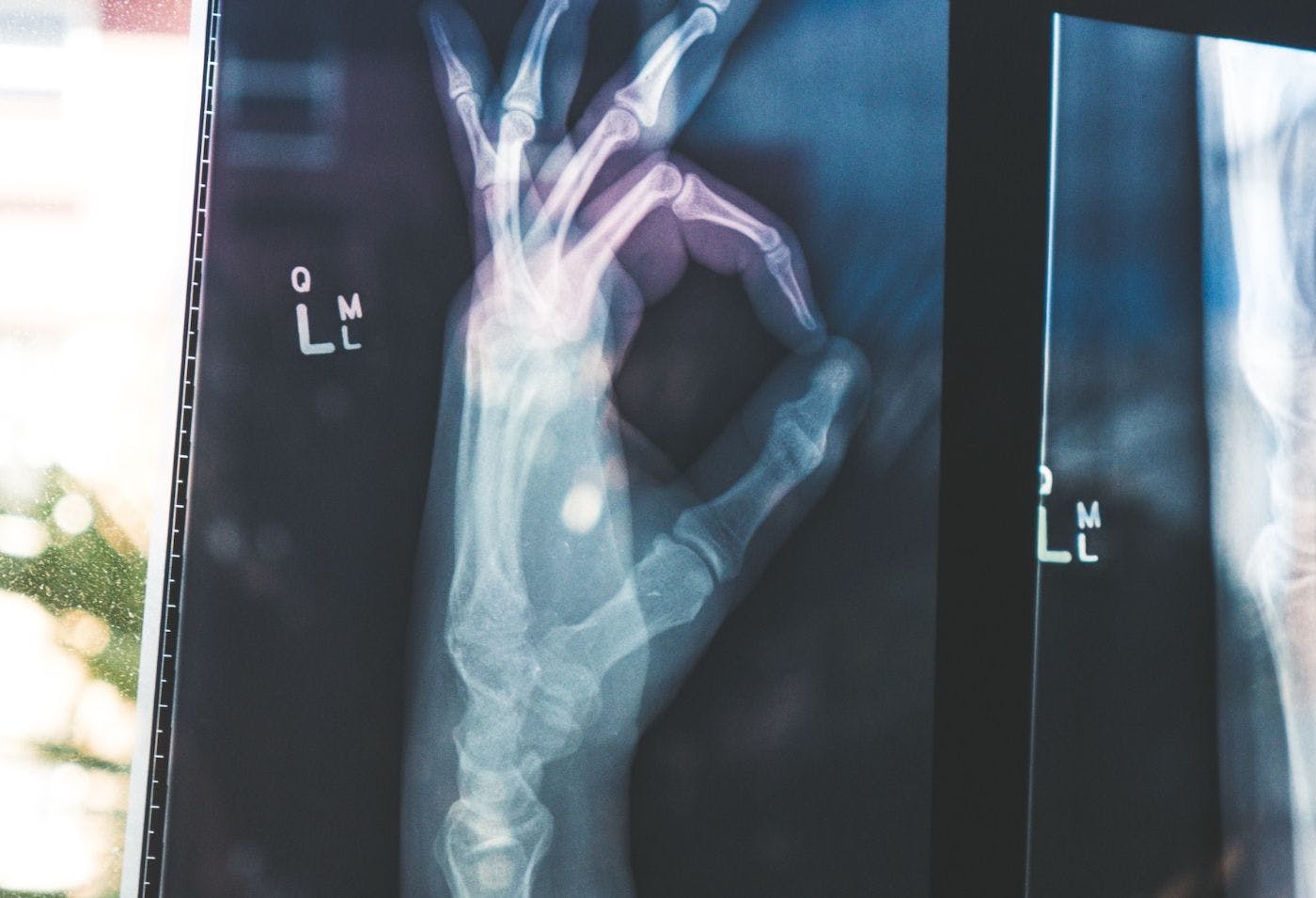 featured image - The Biometric Revolution Will Change Our Approach To Healthcare