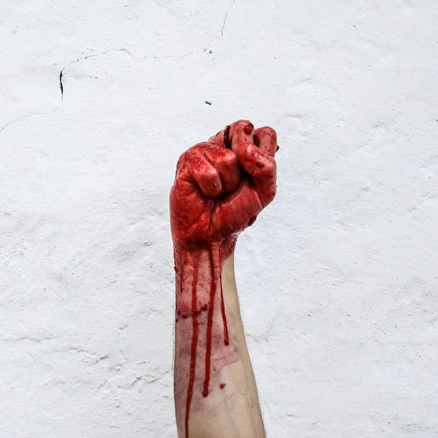 /civilian-casualties-as-collateral-damage-are-they-justified feature image