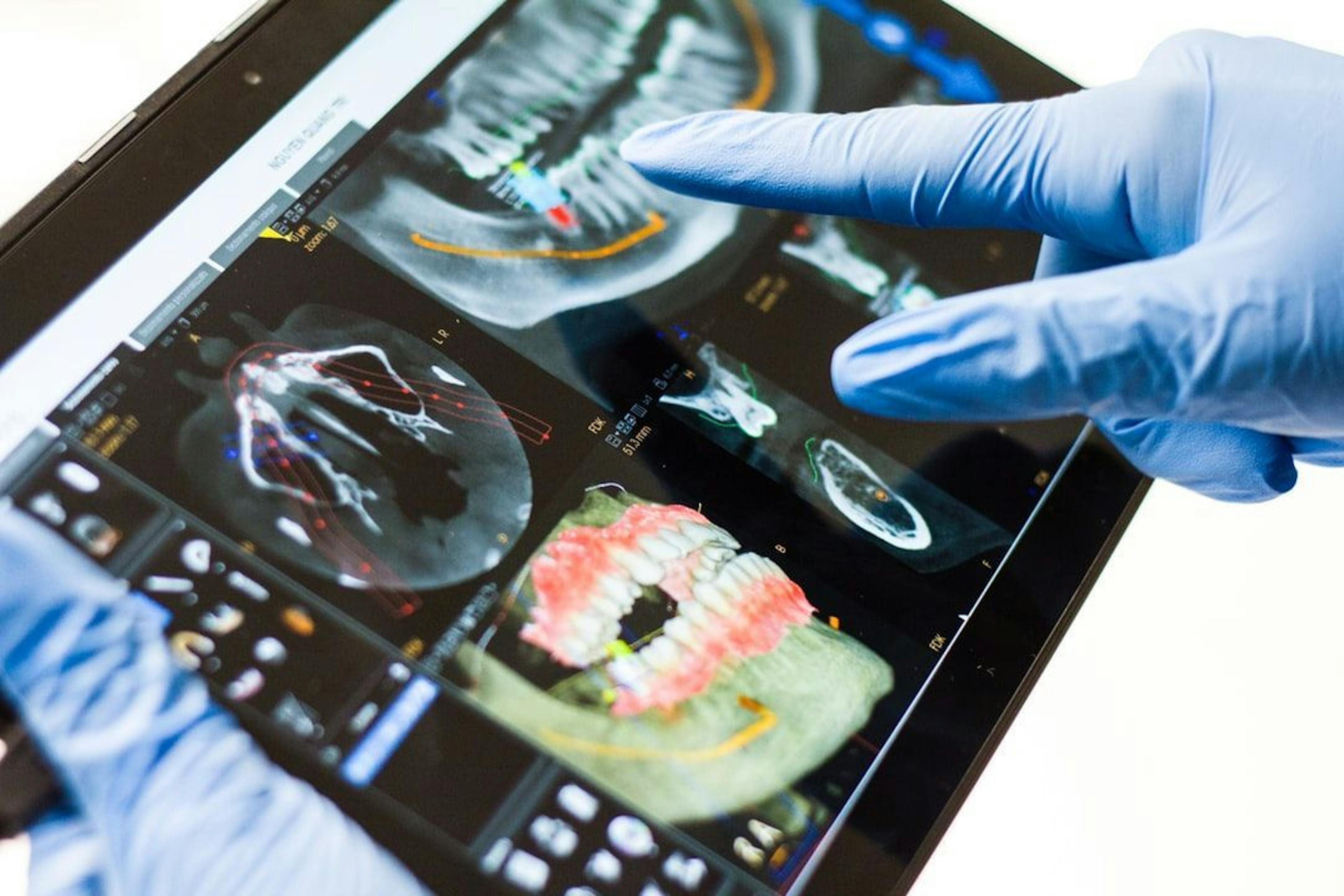 featured image - AI Helps Dentists With Early Detection of Oral Cancer and Cavities