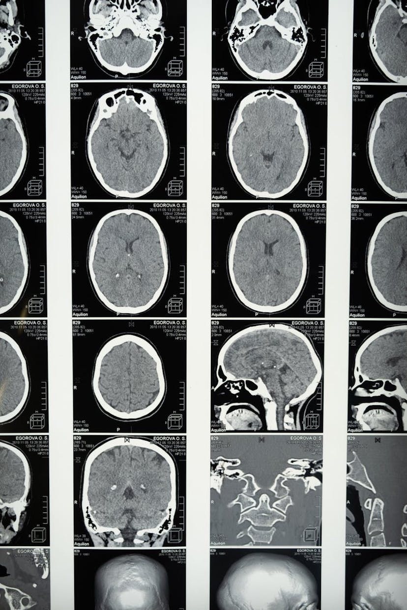 /critical-musings-psychology-validity-and-reliability-of-online-ratings feature image