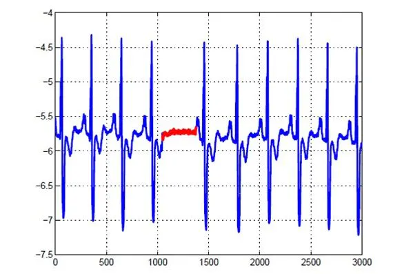 3 Types of Anomalies in Anomaly Detection | HackerNoon
