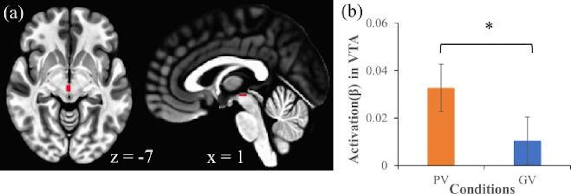 该图像分为两部分：(a) 大脑扫描显示与观看个性化内容相关的特定大脑区域的活动，(b) 条形图显示受试者观看个性化内容时腹侧被盖区 (VTA) 的活动水平存在显着差异与广义视频相比，根据星号表示的键。这表明个性化内容可能会引起与奖励处理相关的更强烈的神经反应。