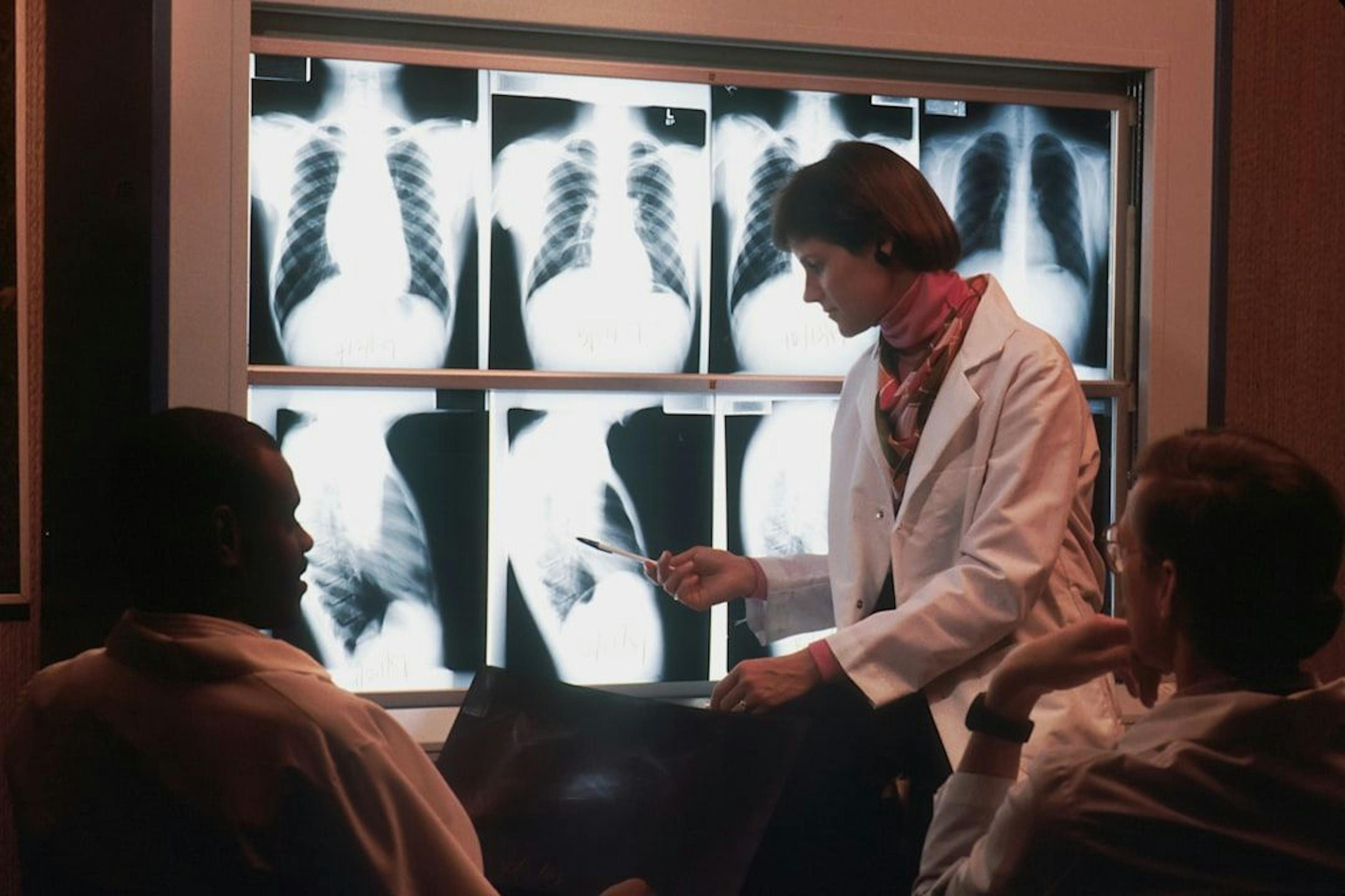 featured image - Aufbau Ihres KI-Radiologen: Eine unterhaltsame Anleitung zum Erstellen eines Lungenentzündungsdetektors mit VGG16