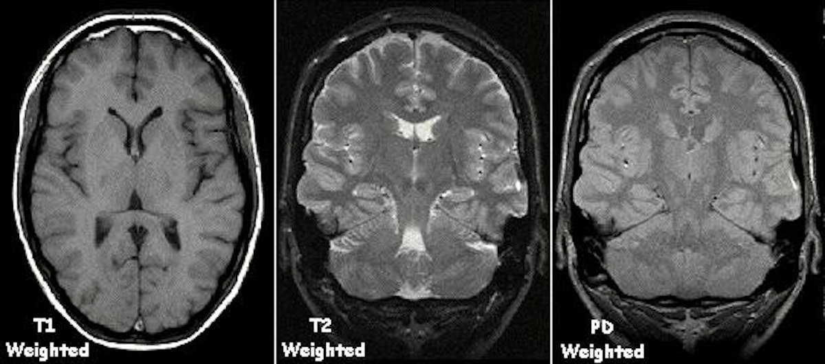 featured image - ¿Se pueden abrir datos médicos (RM, tomografía computarizada, rayos X) en Python y encontrar tumores con IA? Tal vez
