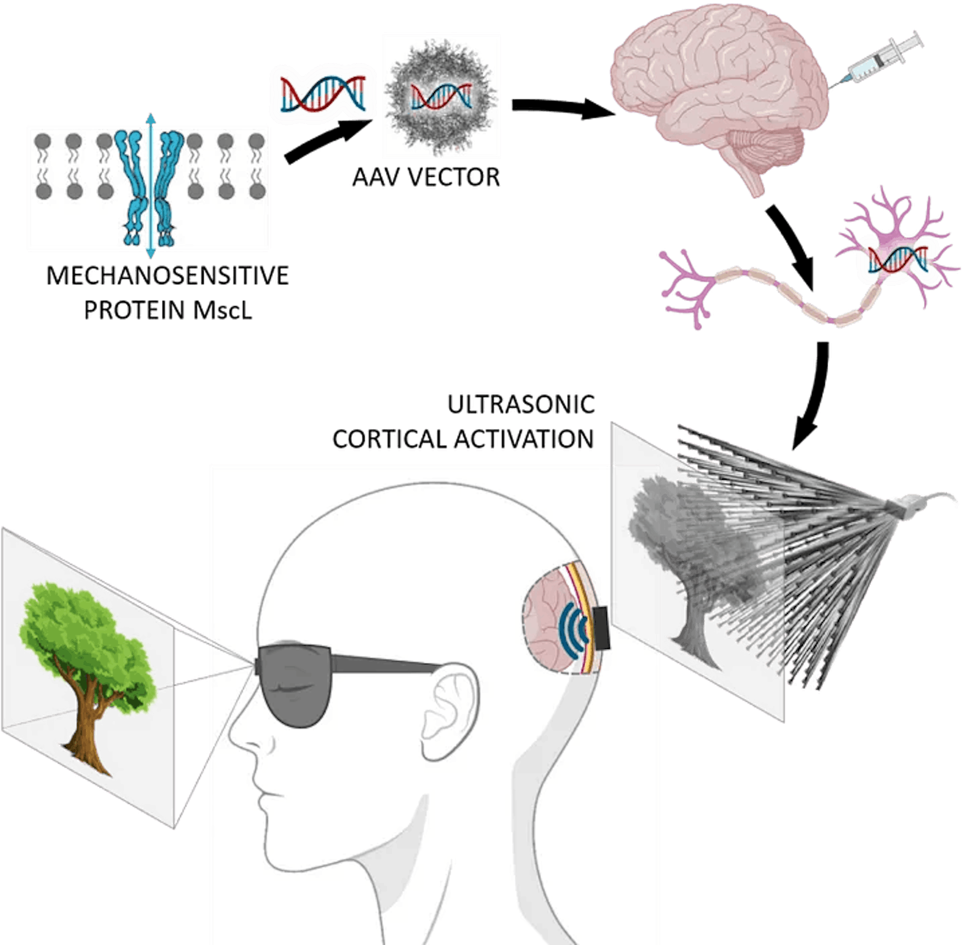 as imagens podem ser projetadas diretamente no cérebro por ultrassom para curar a cegueira, fonte: https://www.physicsformedicine.espci.fr/publication-in-nature-nanotechnology-towards-restoring-vision-using-ultrasound-sonogenetics