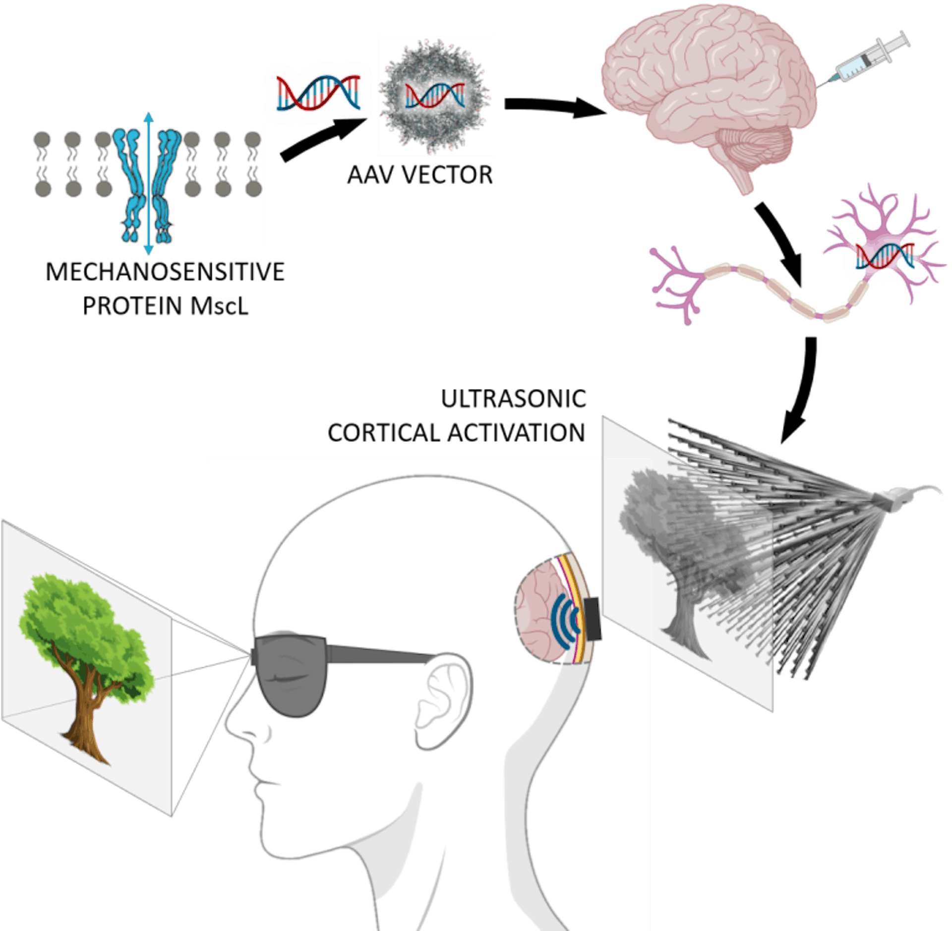 Source: https://www.physicsformedicine.espci.fr/publication-in-nature-nanotechnology-towards-restoring-vision-using-ultrasound-sonogenetics