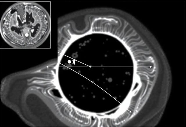 /how-pde-motion-models-boost-image-reconstruction-in-dynamic-ct feature image