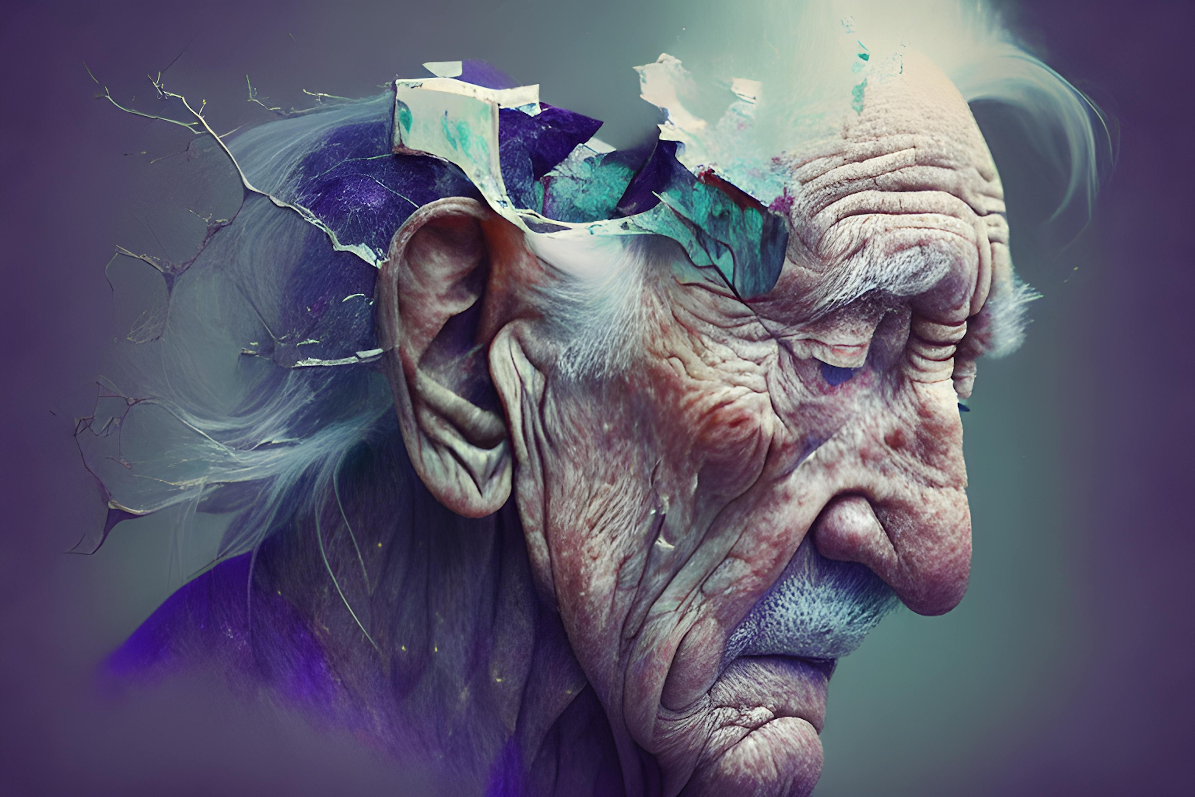 featured image - Aprender um novo idioma pode ajudar a retardar o início da doença de Alzheimer e da demência (Podcast)