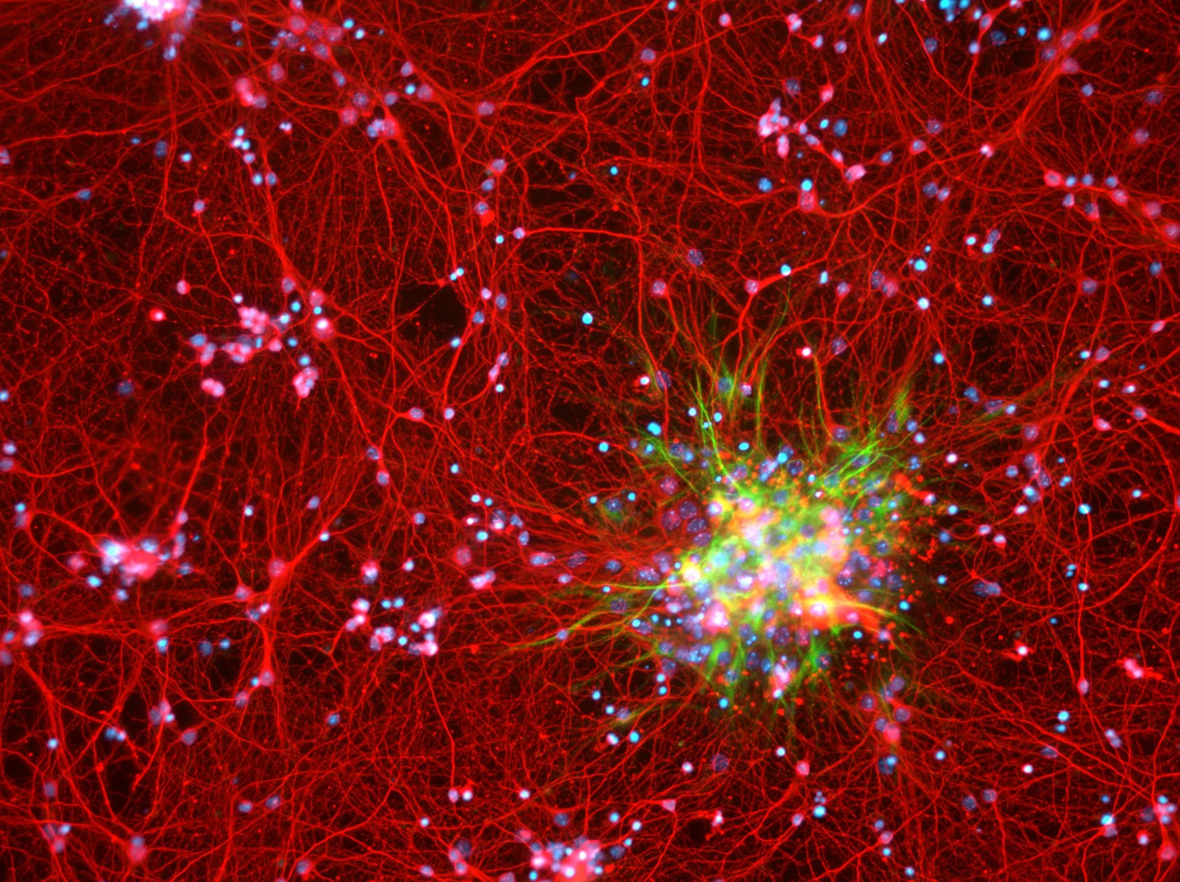 Fluorescence image of a dense network of brain cells radiating from a bright cluster