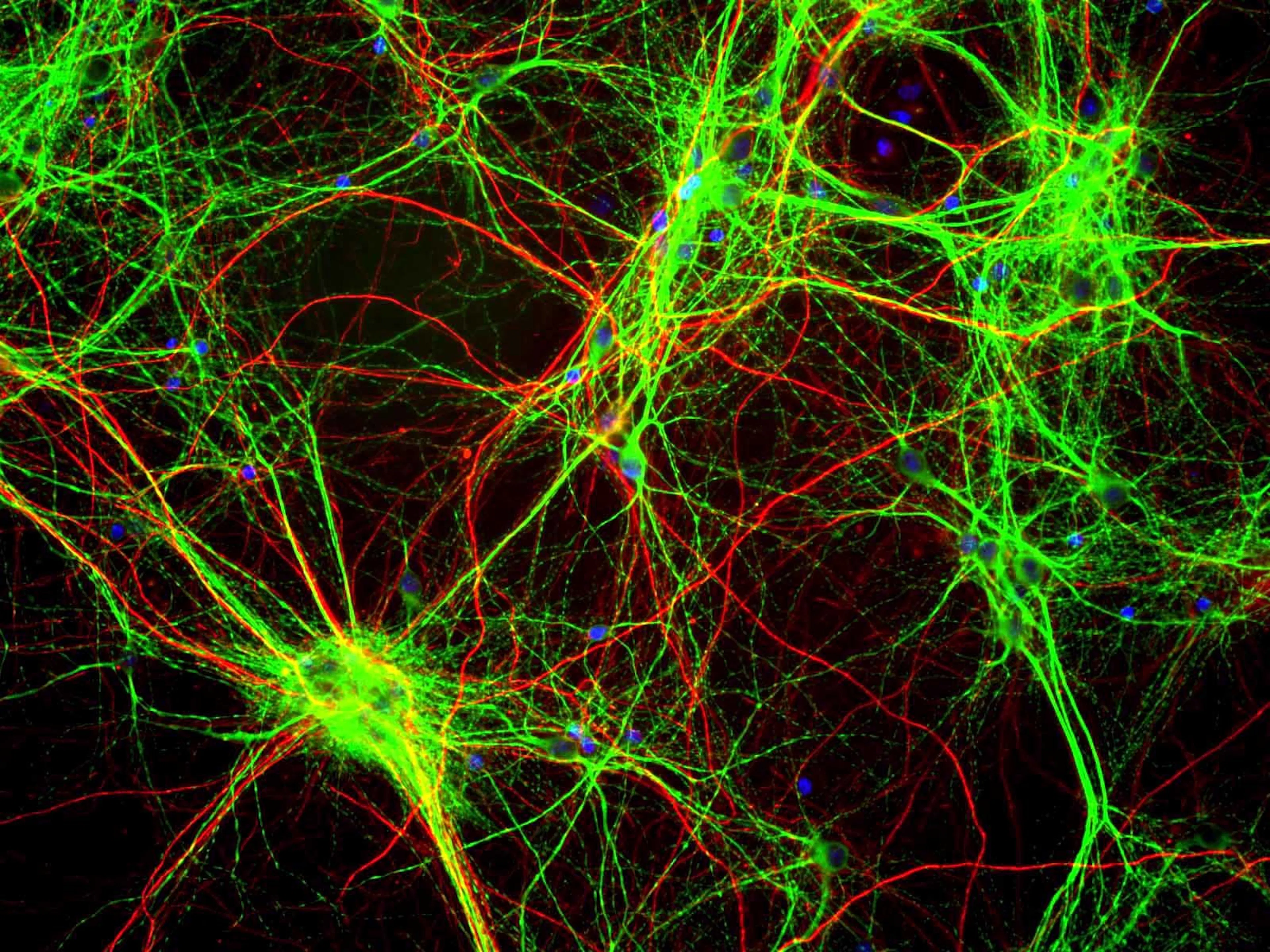 Fluorescence micrograph of cultured brain cells with neurons labeled in green and red