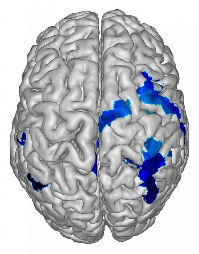 /llms-or-sentience-what-does-consciousness-do-and-how feature image