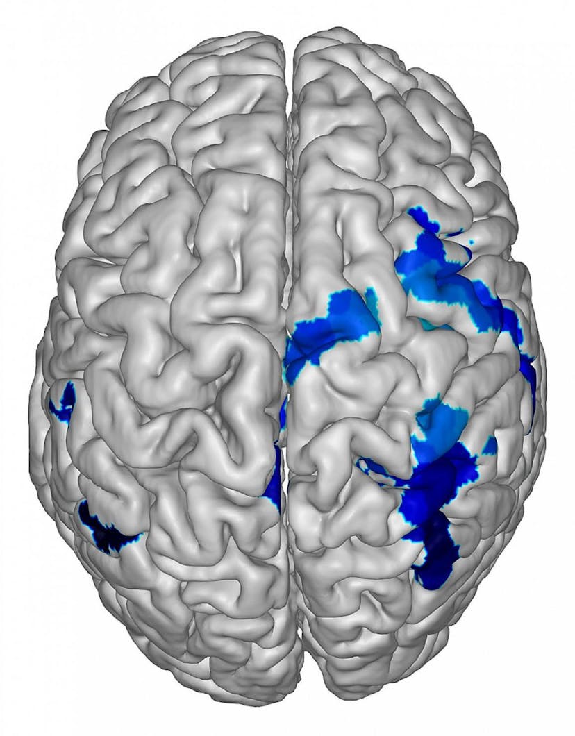 /llms-or-sentience-what-does-consciousness-do-and-how feature image