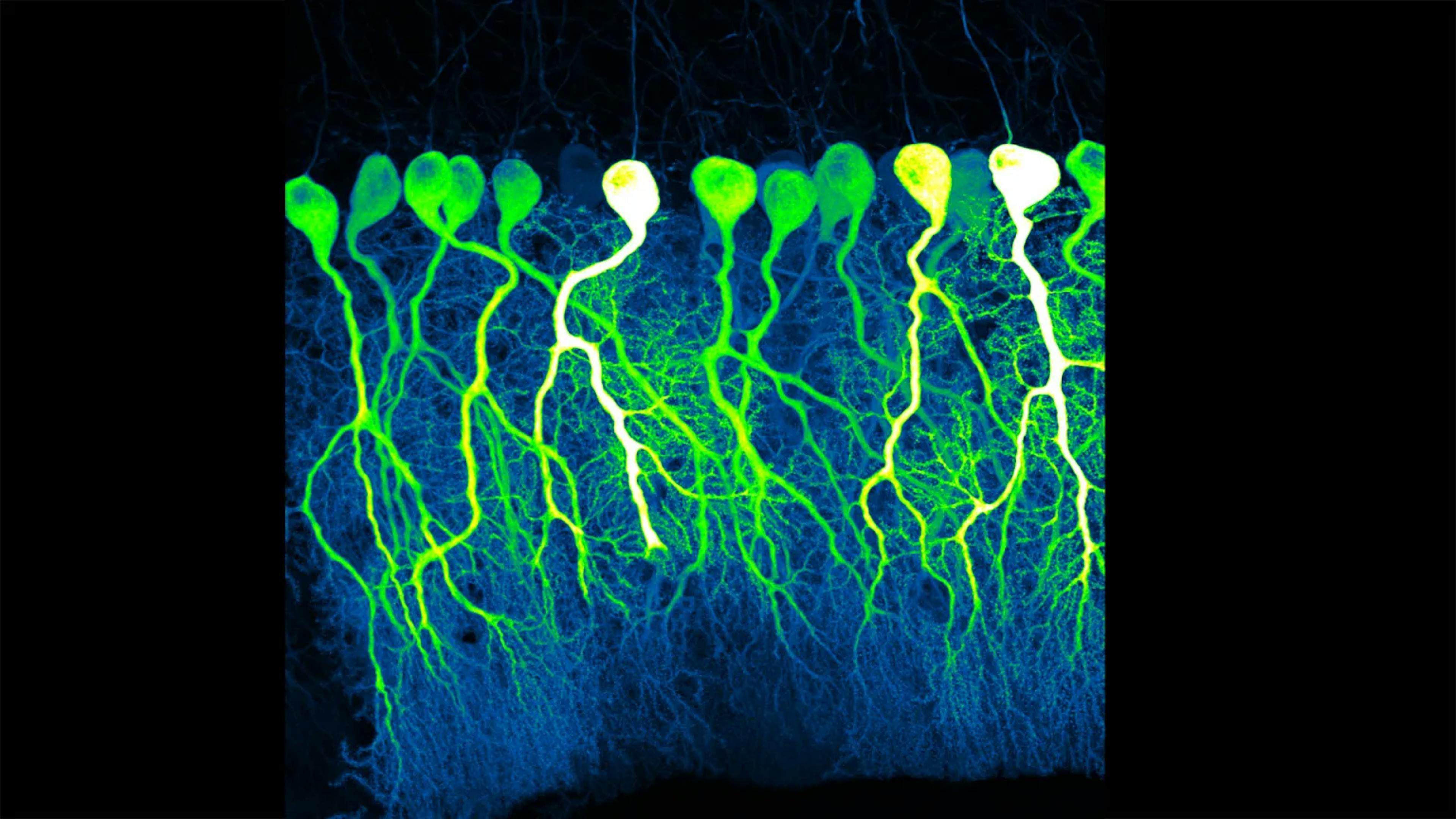 featured image - AI Sentience: How Neural Correlates Setback Consciousness Research