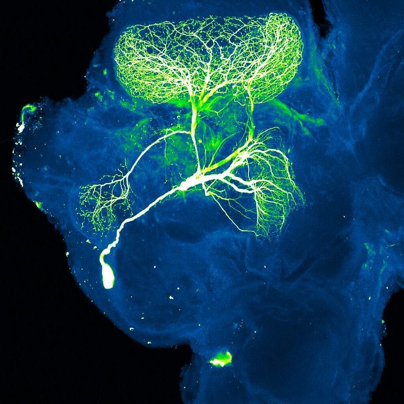 featured image - Neuroscience: Is Consciousness Research Avoiding Mental Health?
