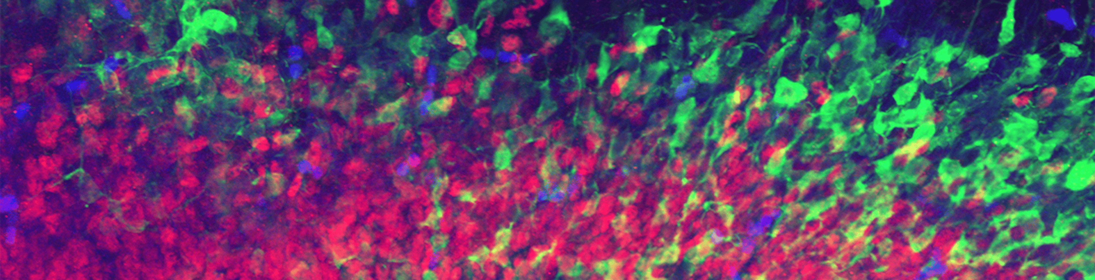 featured image - Mapping the Mind: Can Mice Brains Help Harvard Researchers Chart the Human Connectome?