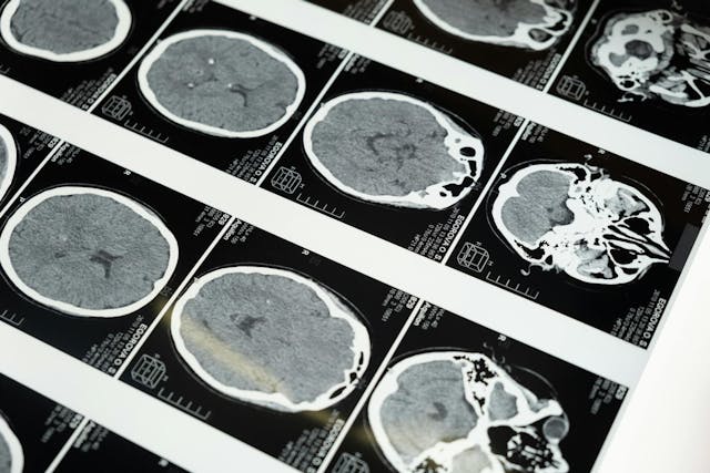 /evaluation-what-is-the-neuroscience-of-superintelligence-agiand-llms feature image