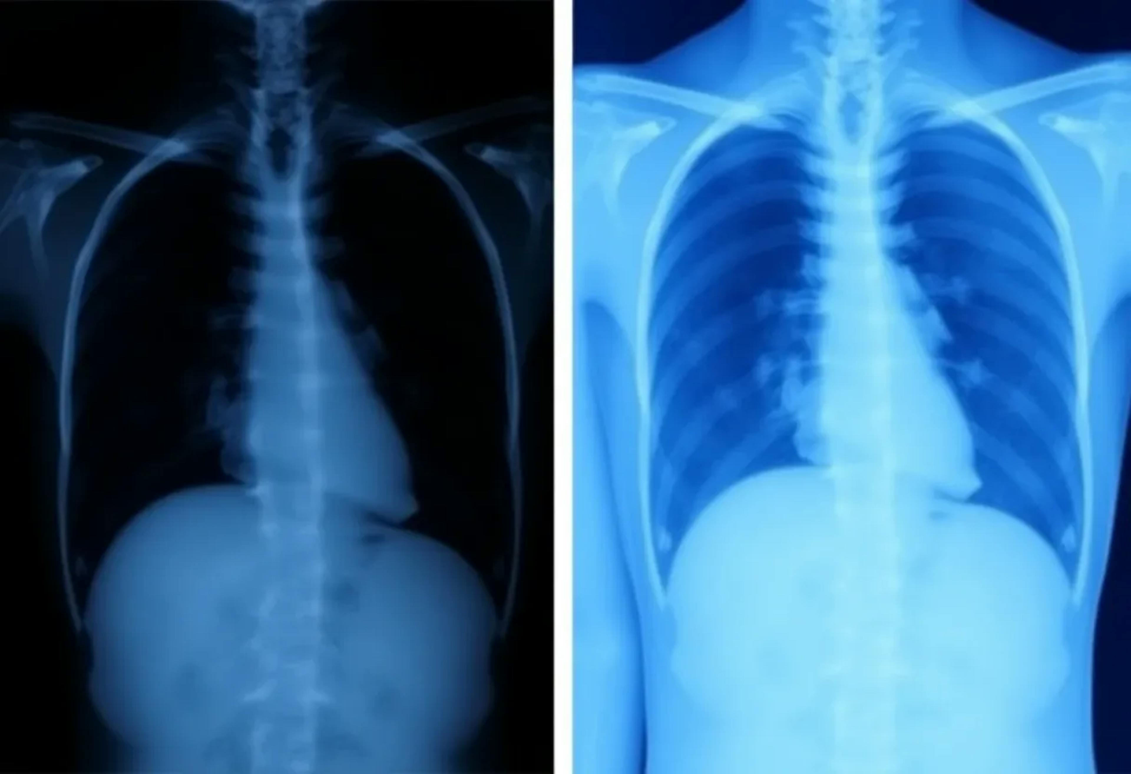 featured image - New Study Shows How Positive-Sum Fairness Impacts Medical AI Models in Chest Radiography