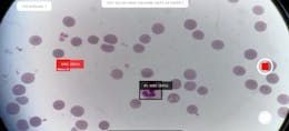 Article Thumbnail