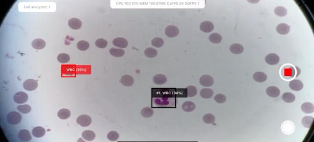 /how-we-turned-the-iphone-into-a-laboratory-microscope-with-ai-and-ble feature image