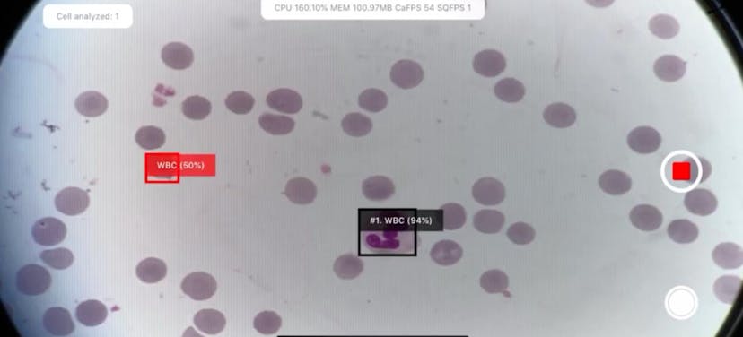 /how-we-turned-the-iphone-into-a-laboratory-microscope-with-ai-and-ble feature image