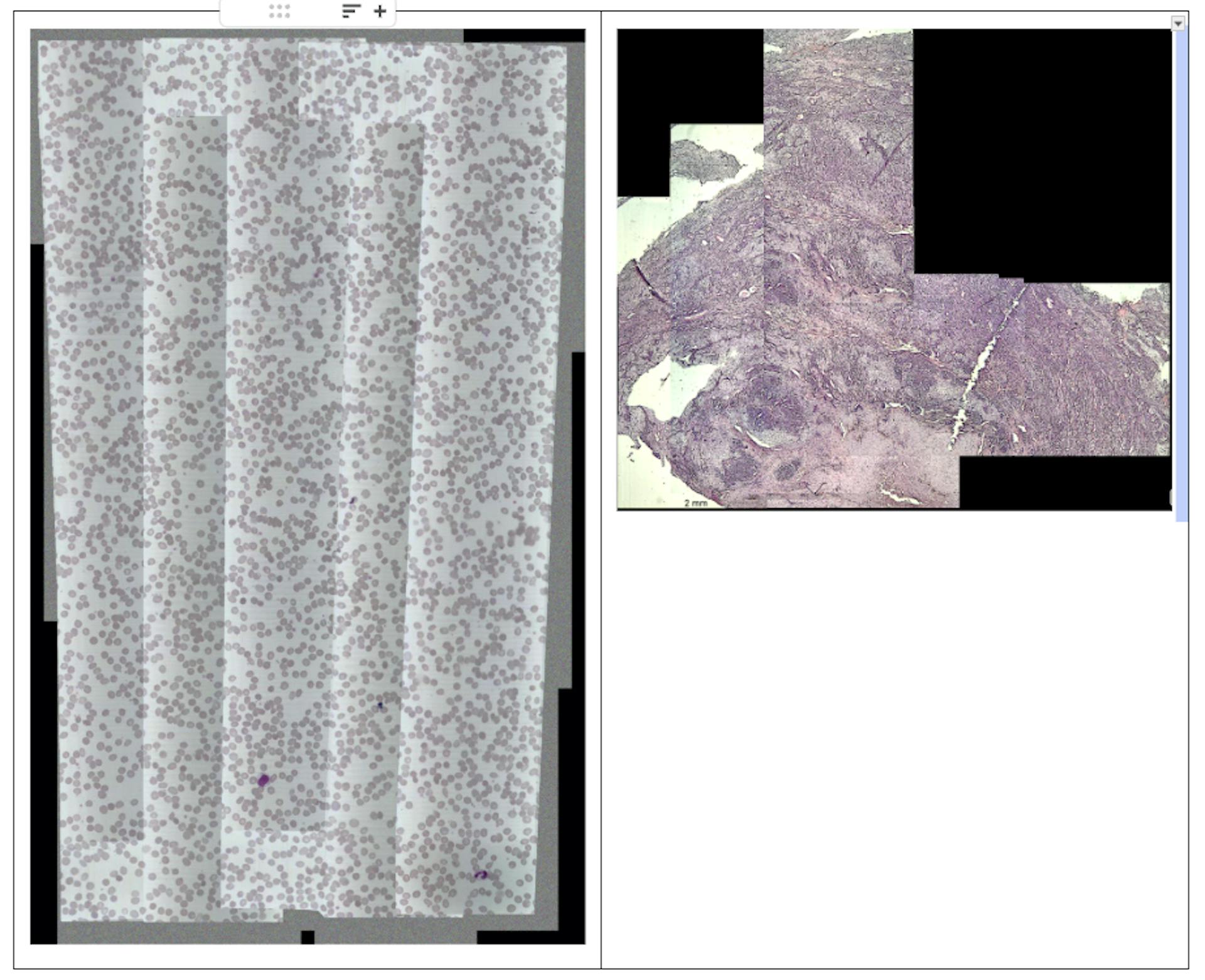 On the left — a map with uneven brightness and exposure, where “seams” are visible at the frame junctions. On the right — unevenly stitched tissue images with gaps.
