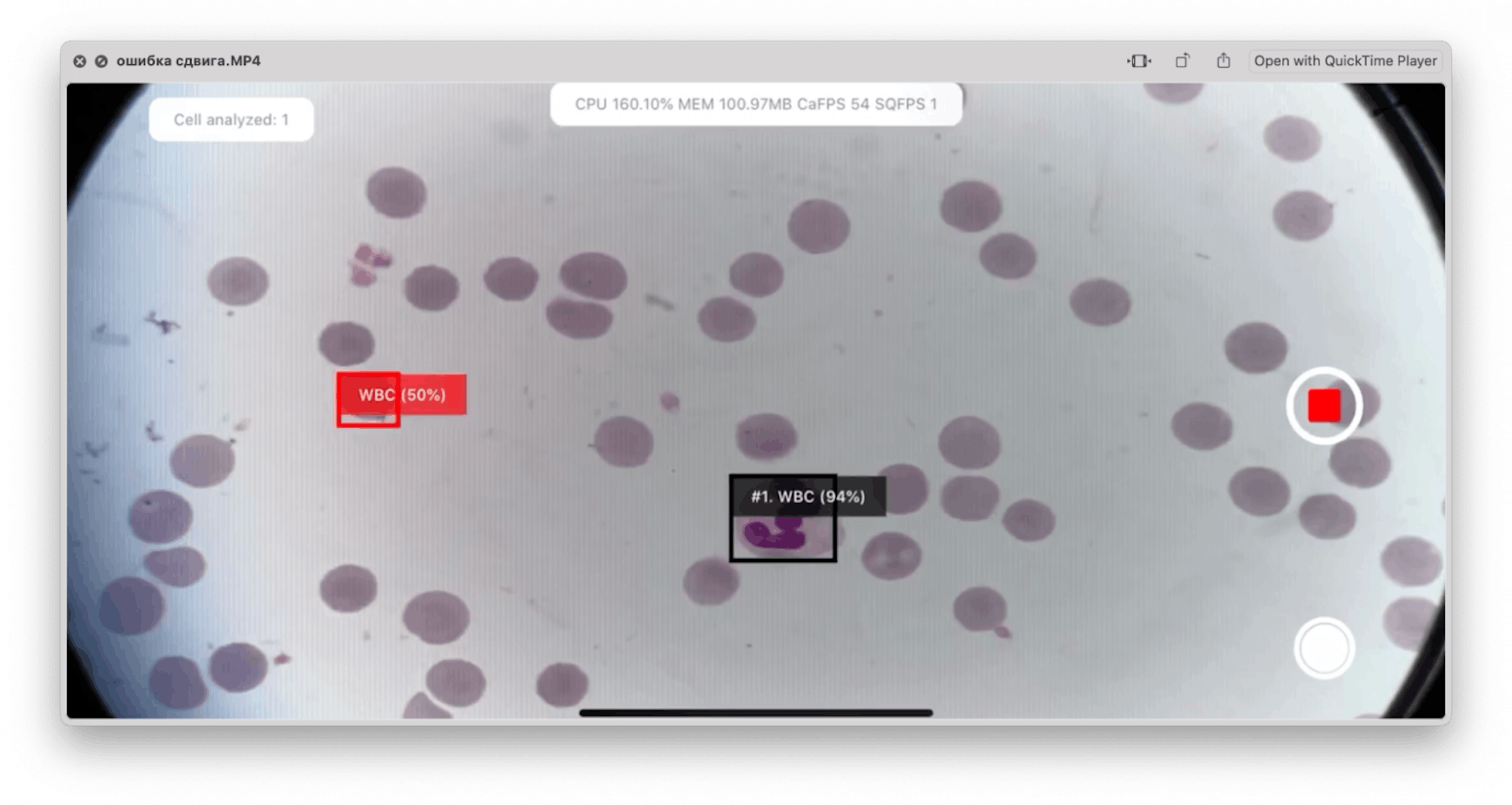 A red highlight marks an erythrocyte discarded by the filters.