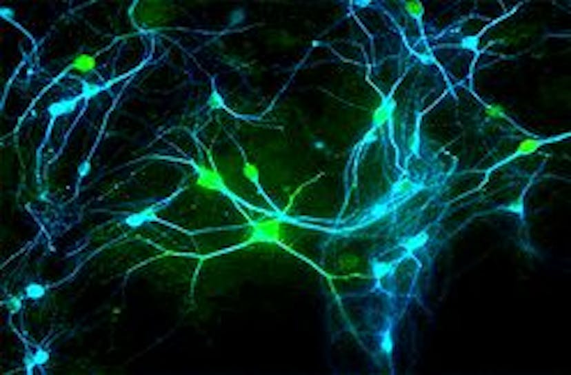 /artificial-neural-networks-anns-have-transformed-the-way-we-interact-with-computers feature image