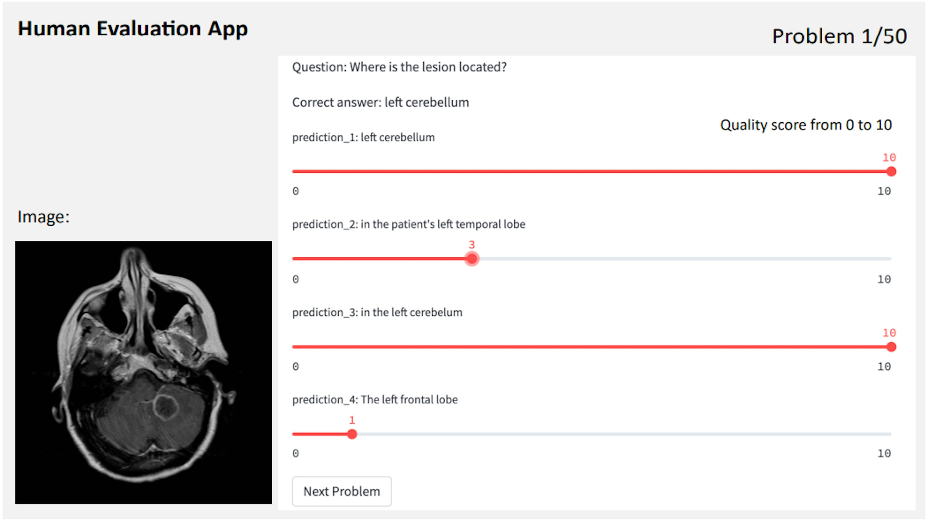 Figure 4: Illustration of our Human evaluation app that we created for clinical experts to evaluate generated answers.