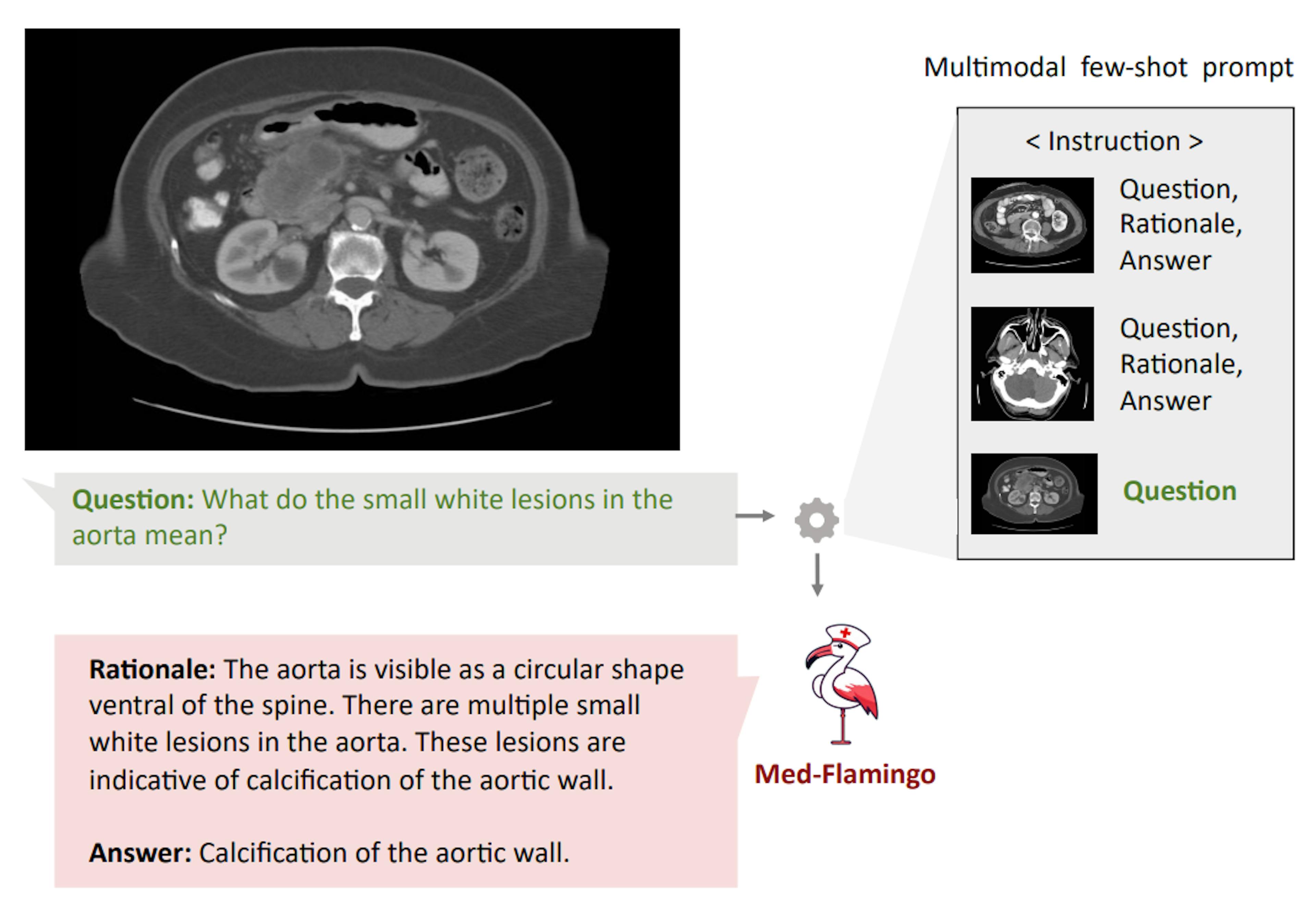 Figure 5: Multimodal medical few-shot prompting illustrated with an example. Few-shot prompting here allows users to customize the response format, e.g., to provide rationales for the provided answers. In addition, multimodal few-shot prompts potentially offer the ability to include relevant context retrieved from the medical literature.
