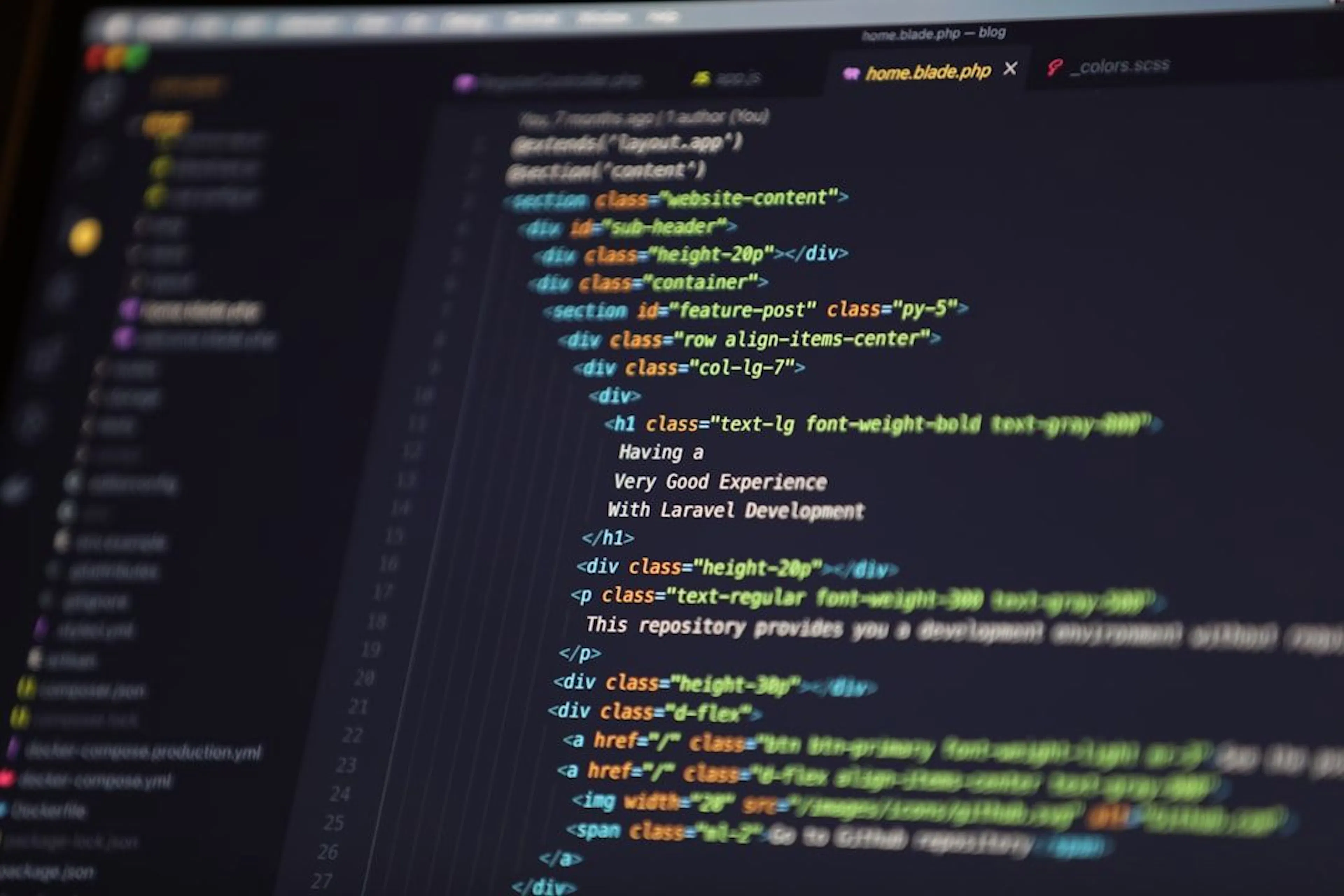 Your AI Coding Stack Needs a Security Policy Before It Needs Another Feature