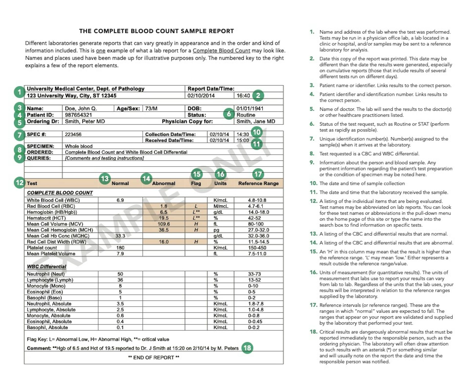Example of CBC report