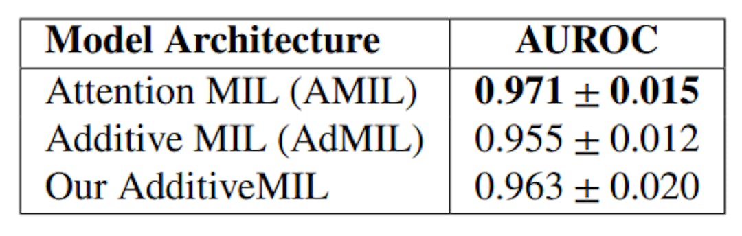 Table 1: Models’ Performance on the tumor detection task. After fine-tuning, we performed the external validation on the test set five times for each model and calculated the average AUC of those 5 runs. The original architecture of AMIL obtained the best performance, followed by our version of AdMIL.