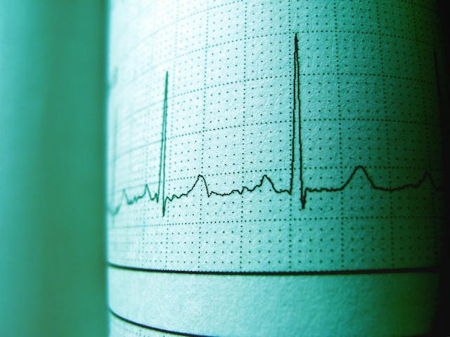 /how-an-open-model-and-a-pile-of-data-are-changing-time-series-analysis feature image
